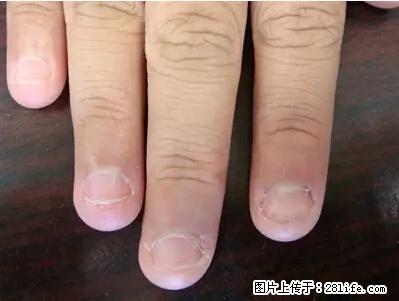 剪指甲、挖耳屎,这些日常小动作竟隐藏大危害! - 吕梁生活资讯 - 吕梁28生活网 lvliang.28life.com